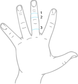 VERTEBRAE RING SIZE REQUIREMENTS